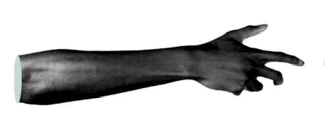 left-arm